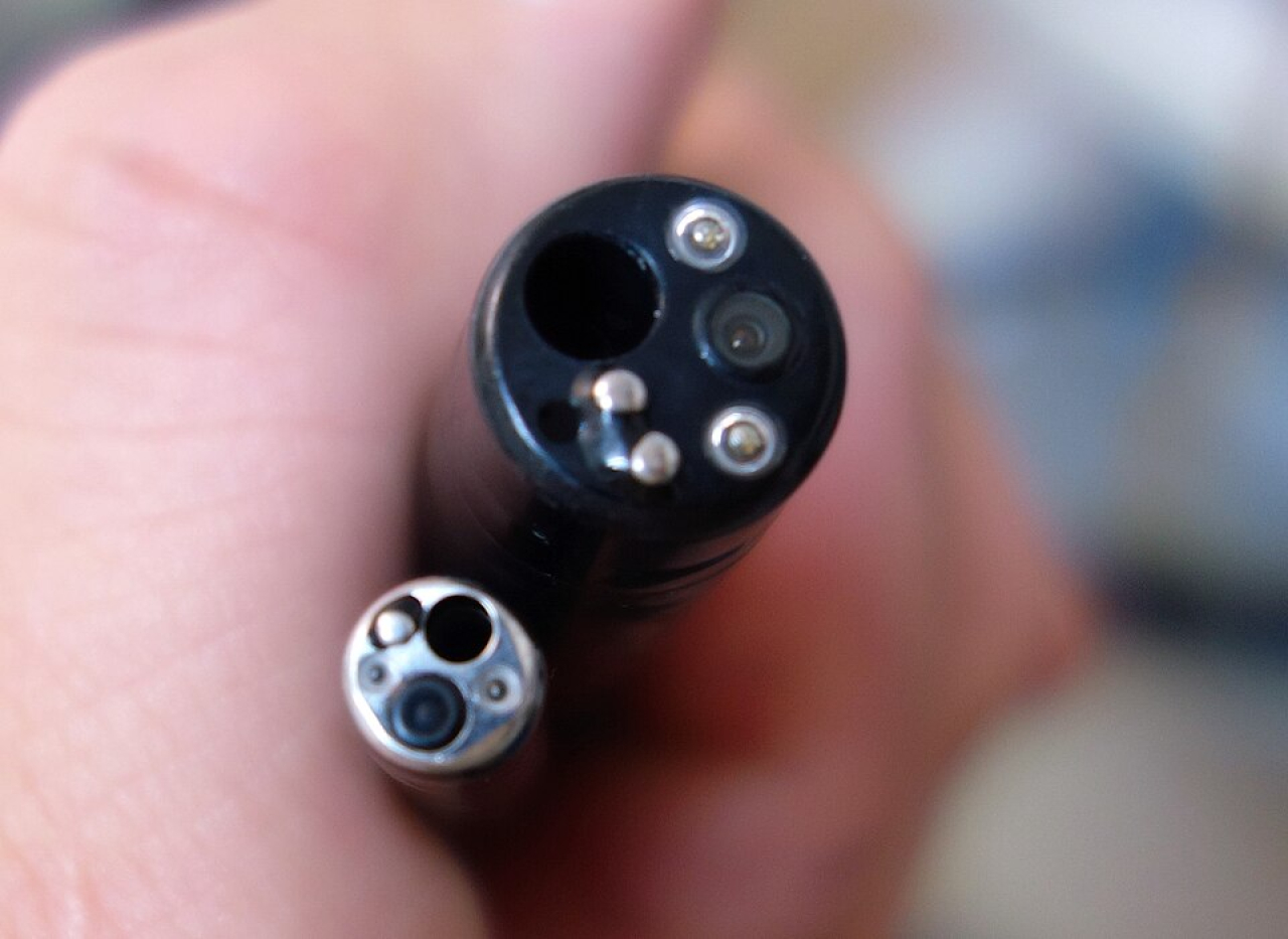 insertion tip of endoscope held in hand.